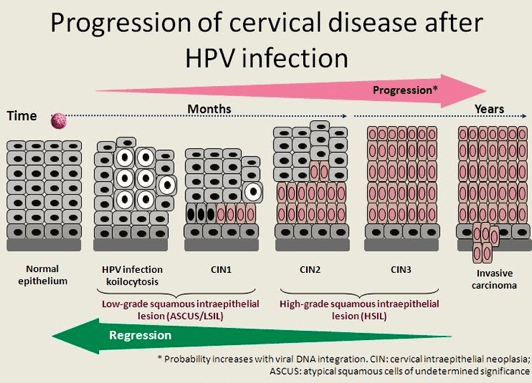 hpv abnormal cells cancer)